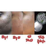 CAC Hydra Gel